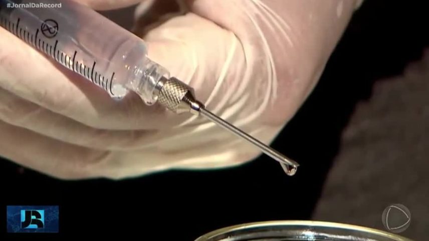 Cirurgião plástico é preso por suspeita de aplicar silicone industrial em mulheres