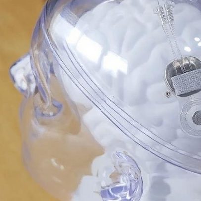 China autoriza uso comercial de implante cerebral para tetraplégicos