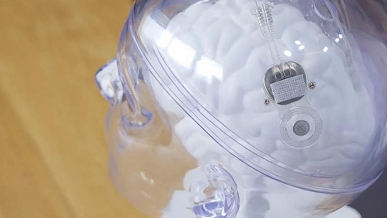 Na imagem, dispositivo da Neuracle que auxilia pacientes a recuperar o movimento das mãos