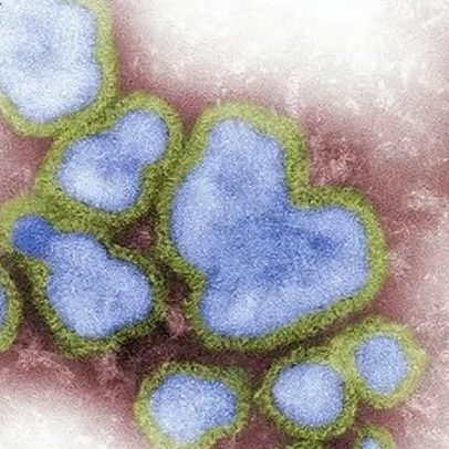 Sorocaba registra 2ª morte por Influenza em 2026