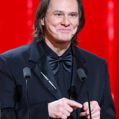 Cirurgião plástico famoso defende novo visual drástico de Jim Carrey