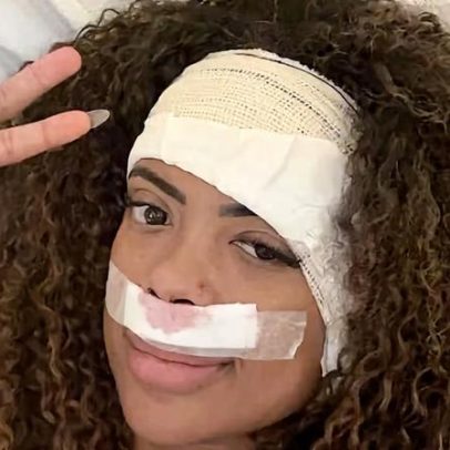 Saúde de Marvvila é atualizada após cirurgia para remoção de tumor