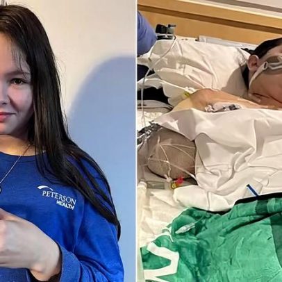Menina perde pernas e braço após complicação de gripe