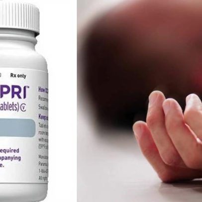 Anvisa aprova tratamento com cenobamato para epilepsia grave