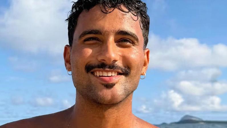 Ex-BBB Lucas Pizane revela resultado de ‘compensação’ para corrigir assimetria facial; veja antes e depois — Foto: Reprodução/Instagram