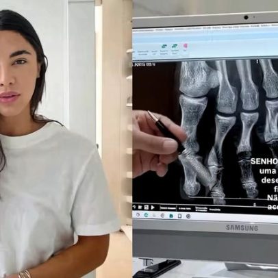 Gabriela Versiani sofre acidente doméstico após recuperação de disenteria