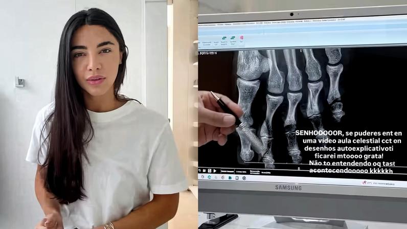 Gabriela Versiani sofre acidente doméstico após recuperação de disenteria