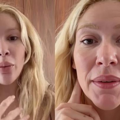 Karoline Lima aparece com olhos inchados após chorar muito