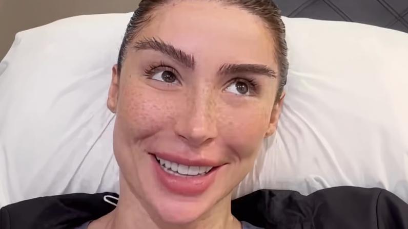 ‘Não se assustem’: Bianca Andrade revela efeito inesperado e pouco falado do transplante de sobrancelha — Foto: Reprodução/Instagram