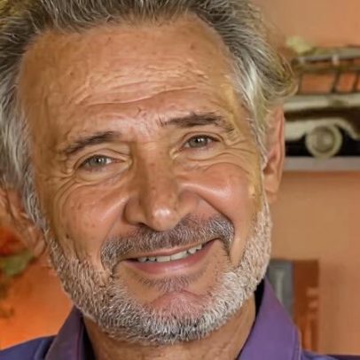 Nelson Freitas faz harmonização facial aos 63 anos e mostra o resultado