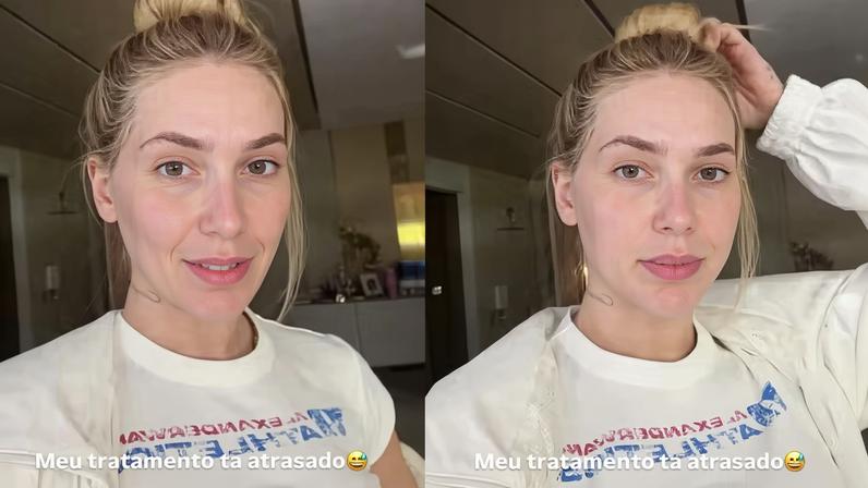 Virginia Fonseca revela atraso no tratamento de enxaqueca e dor intensa