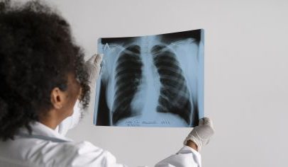 Radiografias falsas criadas por IA enganam radiologistas e a própria IA