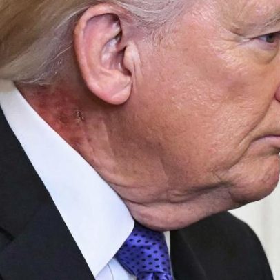 Pescoço de Trump é comparado a erva verde