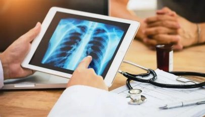 Dia Mundial da Tuberculose novos antibióticos podem combater a doença