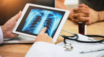Nanopartículas com antibióticos pode acelerar tratamento da tuberculose