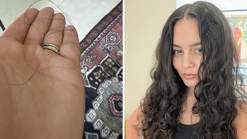 Vanessa Hudgens revela queda de cabelo pós-parto e comenta início