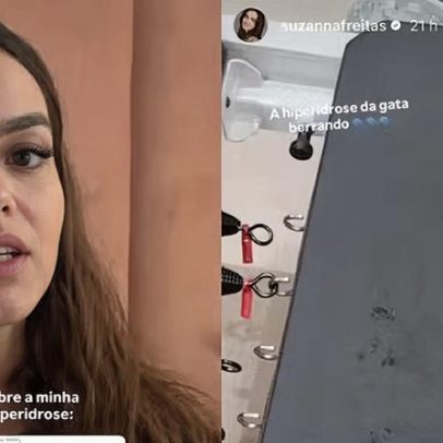 Suzanna Freitas detalha limitações da hiperidrose intensa e comenta aceitação