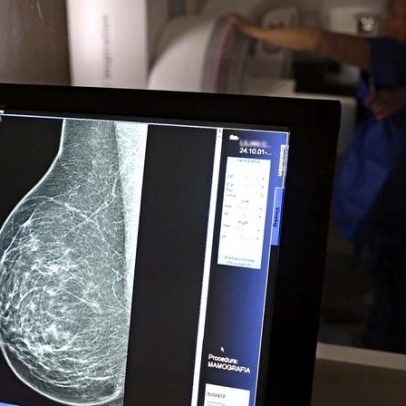 Nova lei garante três folgas anuais para exames preventivos