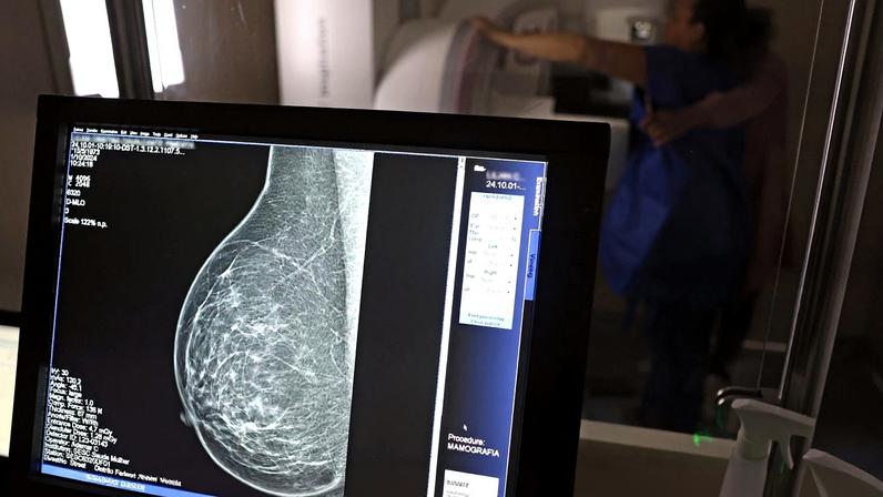 Brasília (DF), 01/10/2024 - Teste de mamografia realizado na Campanha Outubro Rosa: Sesc-DF, que oferece exames e consultas gratuitas às mulheres. Foto: José Cruz/Agência Brasil
