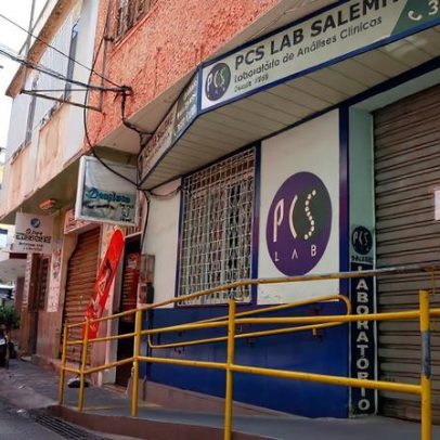 Paciente que recebeu transplante de órgão com HIV em 2024 morreu