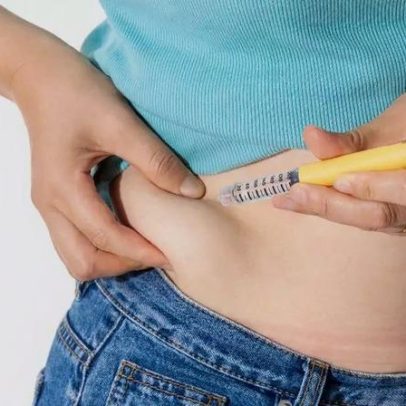 Caneta emagrecedora funciona para sempre? Diferenças em relação à bariátrica