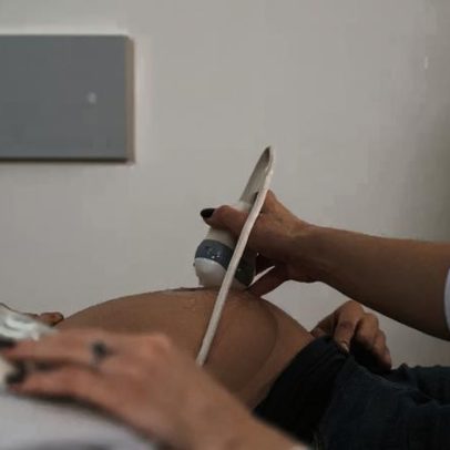 Placenta baixa na gestação pode exigir monitoramento obstétrico