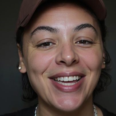 Pabllo Vittar divulga resultado da terceira rinoplastia e gera debate