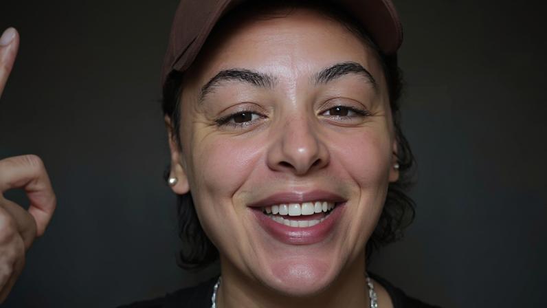 Pabllo Vittar revela novo visual após terceira rinoplastia e comenta fase de recuperação.