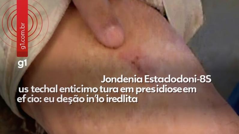 Defensoria gravou presos feridos um dia depois de ação do Grupo de Intervenção Rápida