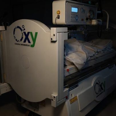 Hospital do AM inaugura câmaras hiperbáricas pelo SUS