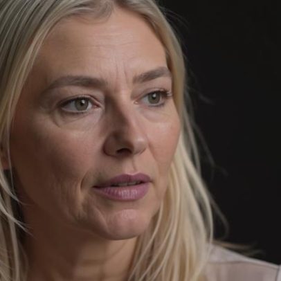 Virginia Fonseca volta a enfrentar alopecia, faz tratamento após alerta médico