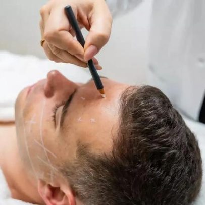 Cirurgias plásticas entre homens quase dobram, aponta estudo