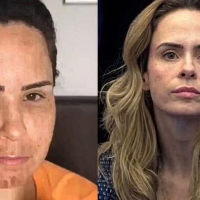 BBB 26: Web encontra vídeo antigo de Ana Paula com rosto diferente