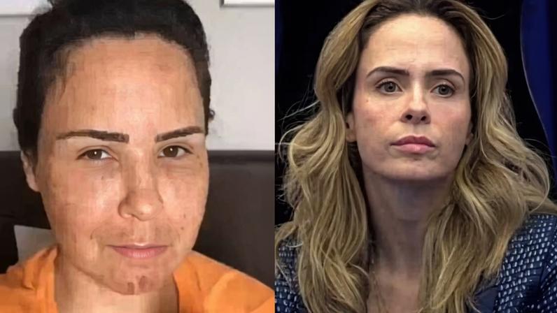 BBB 26: Web encontra vídeo antigo de Ana Paula com rosto diferente