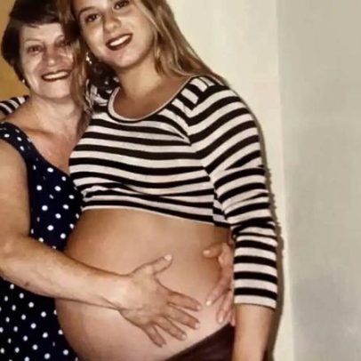 Poliana Rocha viraliza com foto de antes de cirurgias plásticas
