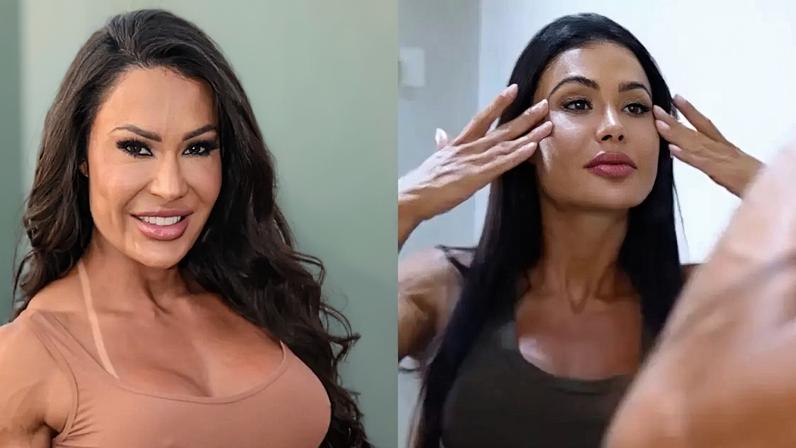 Gracyanne Barbosa antes e depois: ex-BBB retira preenchimentos do rosto, aposta em procedimentos tecnológicos e é confundida com Kim Kardashian.