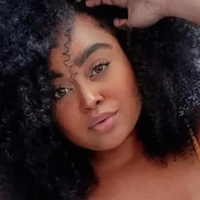 Ex-BBB Rízia Cerqueira sofre acidente grave de moto elétrica