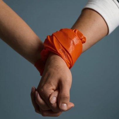 Mãos inchadas associam retenção simples a doenças crônicas