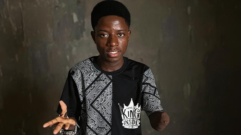 Estudante na Nigéria foi torturado, perdeu a mão e luta pela educação