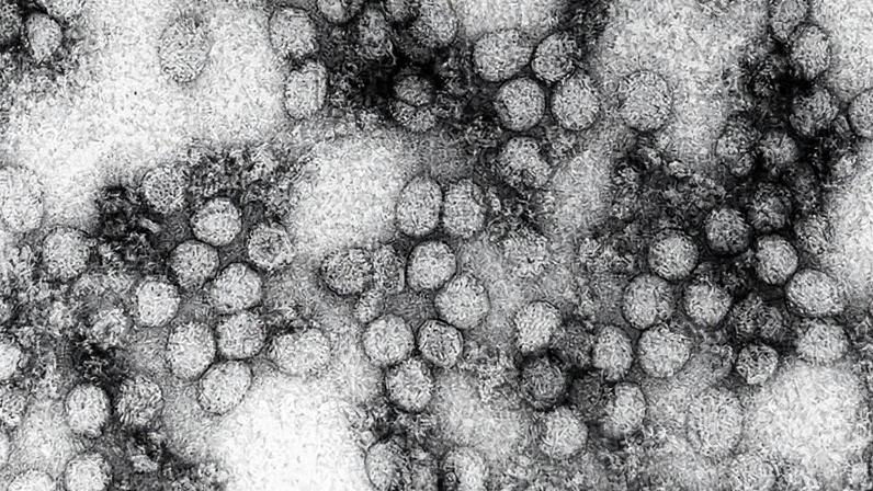 Estudo sugere que o risco de reemergência da transmissão urbana não pode ser descartada. Na imagem, eletromicrografia de transmissão do vírus da febre amarela – Foto: Erskine Palmer, Centers for Disease Control and Prevention Publich Health Image Library/Domínio público via Wikimedia Commons
