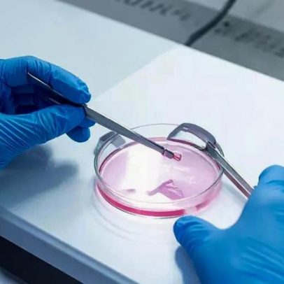 Congelar óvulos: alerta de especialista sobre maternidade no futuro