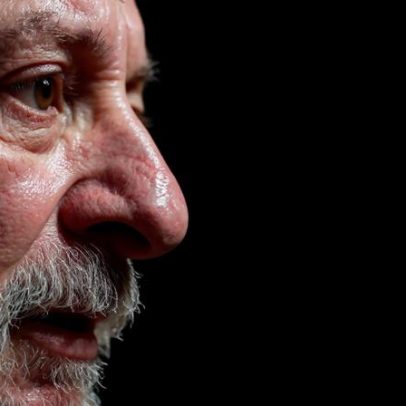 Lula é internado para procedimento na cabeça e infiltração na mão