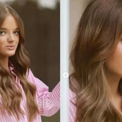 Rafaella Justus mostra resultado de rinoplastia; quando revisão é indicada