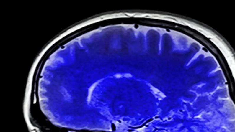Nutriente desconhecido é vital para o desenvolvimento do cérebro