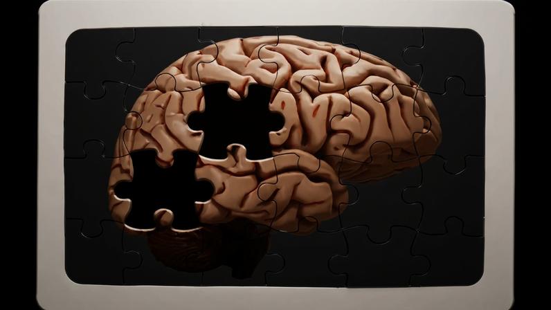 Fotografia de um Quebra-cabeça cerebral faltando uma peça