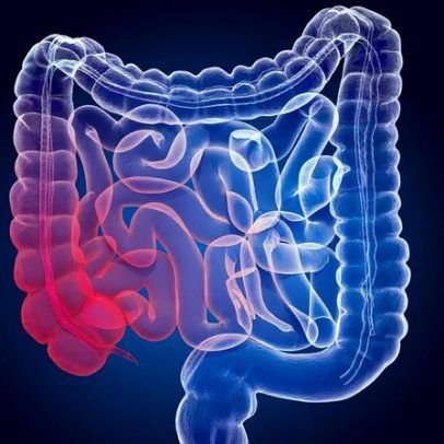 Coloproctologista indica formas naturais de desinflamar o intestino