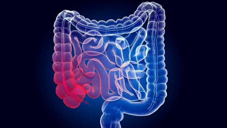 Coloproctologista indica formas naturais de desinflamar o intestino