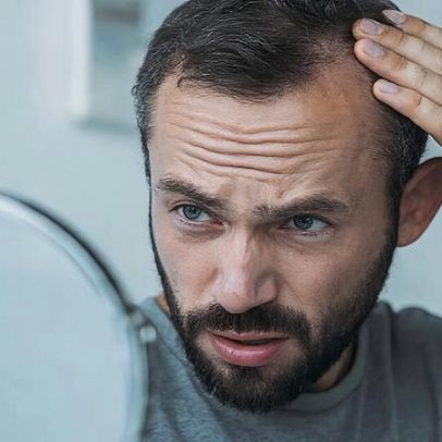 Corte texturizado: técnica para disfarçar a calvície com volume
