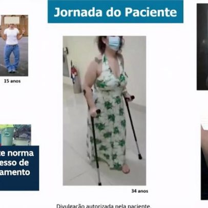 Debatedores na CDH defendem ampliar uso de medicamento contra raquitismo