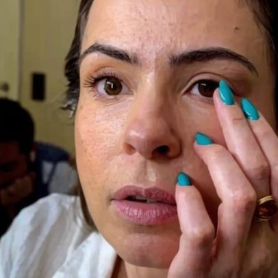 Caso Ana Paula Renault acende debate sobre lentes de grau seguras